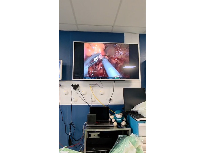 Gastrointestinal Surgery – France Hospital